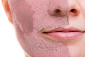 French Rose Clay Mask