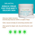 Baby Eczema Cream | Organic eczema cream | Elizabeth Parker Naturals